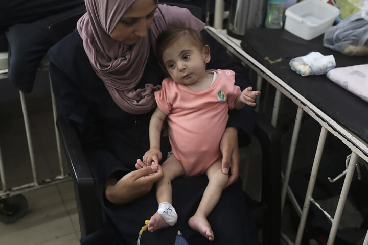 L’infanzia di Gaza uccisa con la fame