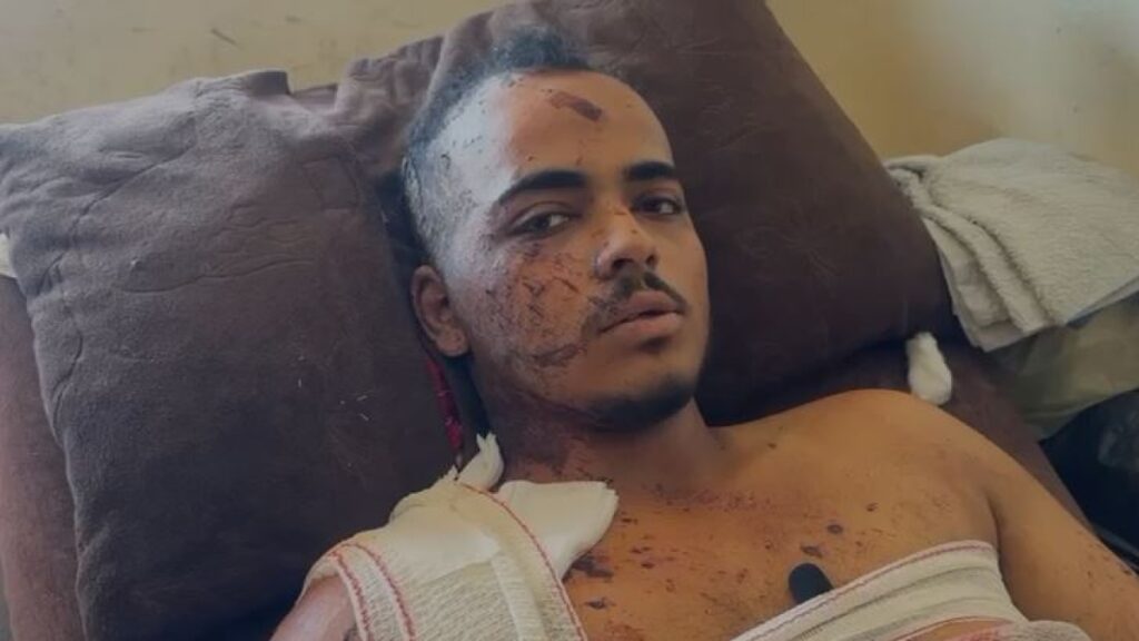 Jamal Badah, fotografo sopravvissuto all'attacco dell'ospedale Nasser a Gaza, racconta la tragedia