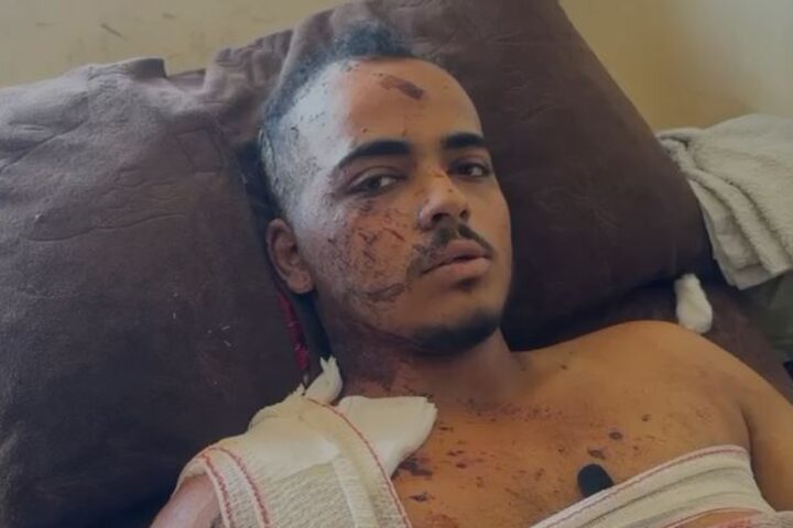 Jamal Badah, fotografo sopravvissuto all'attacco dell'ospedale Nasser a Gaza, racconta la tragedia