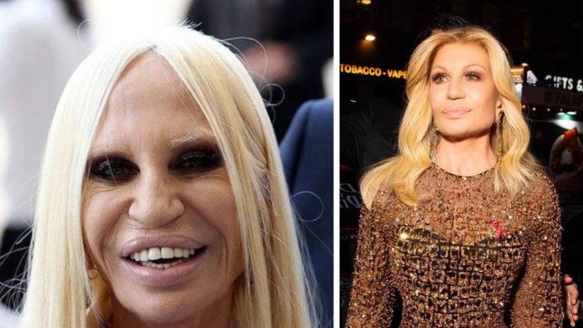 La ricerca della bellezza autentica: il chirurgo Giulio Borbon parla di armonia e invecchiamento