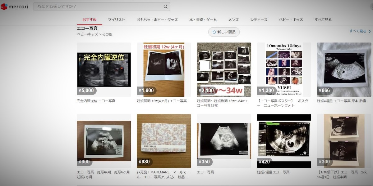 Mercari vieta la vendita di ecografie di feti per prevenire possibili truffe