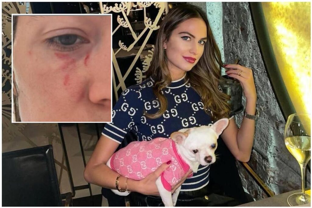 Pamela Genini temeva per la sua vita: il referto medico del 2024 riporta minacce di Gianluca Soncin