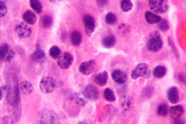 La giunta dell'Andalusia pubblica per errore dati sensibili di 23 pazienti malati di cancro