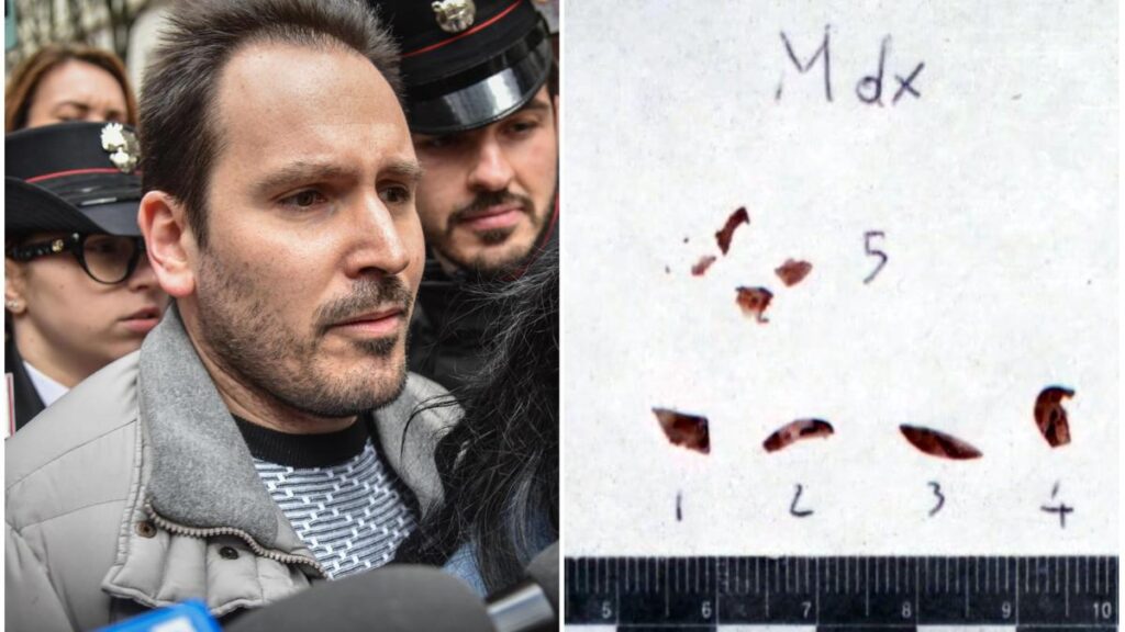 Tracce di Dna sulle unghie di Chiara Poggi: la consulenza della genetista Albani incalza Sempio, la difesa ribatte: “Non è una prova, è innocente”