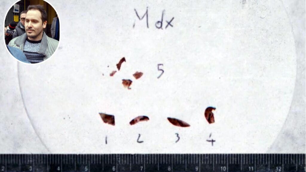 Garlasco, la genetista Denise Albani conferma: "Il Dna di Chiara Poggi legato a Andrea Sempio"