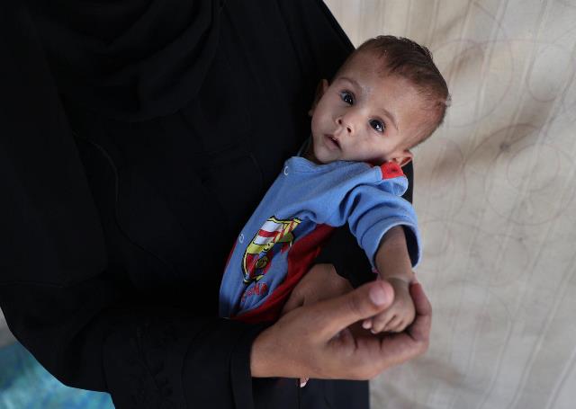 Malnutrizione in aumento a Gaza: il 10% dei neonati è sottopeso, denuncia UNICEF