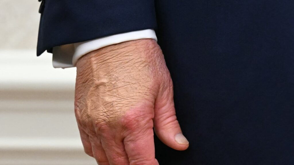 Trump difende il suo stato di salute dopo l'intervista al Wall Street Journal