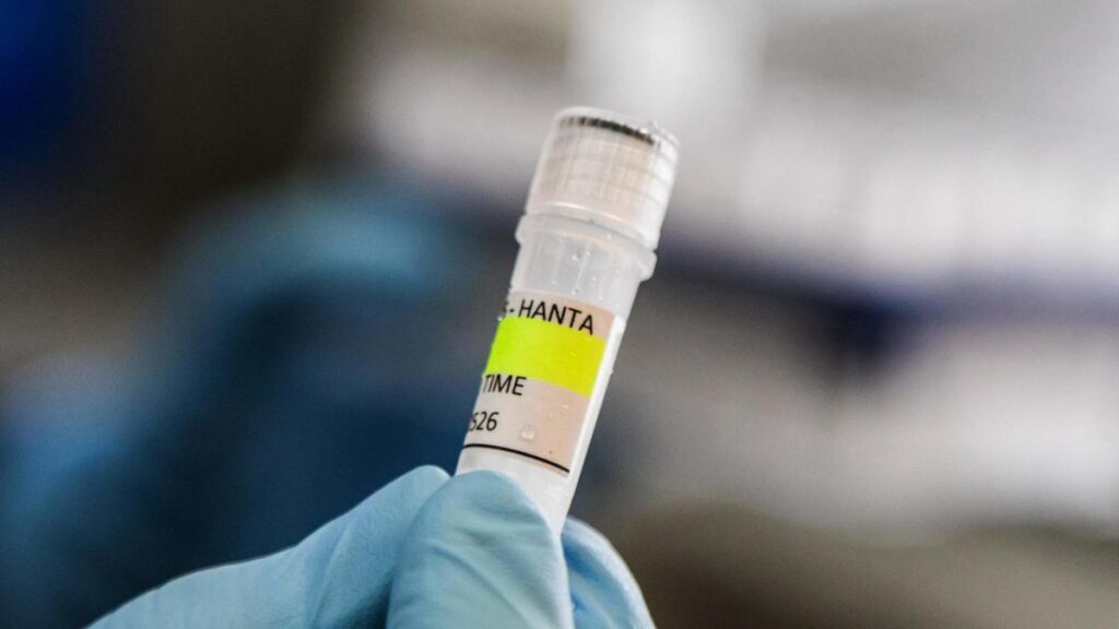 Focolaio di hantavirus a bordo della nave MV Hondius: tre morti e allerta bassa in Italia