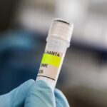 Focolaio di hantavirus a bordo della nave MV Hondius: tre morti e allerta bassa in Italia
