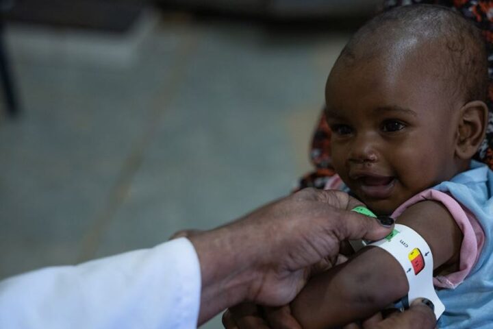 Sudan: 825.000 bambini a rischio di morte per grave malnutrizione, avvertono FAO, WFP e UNICEF
