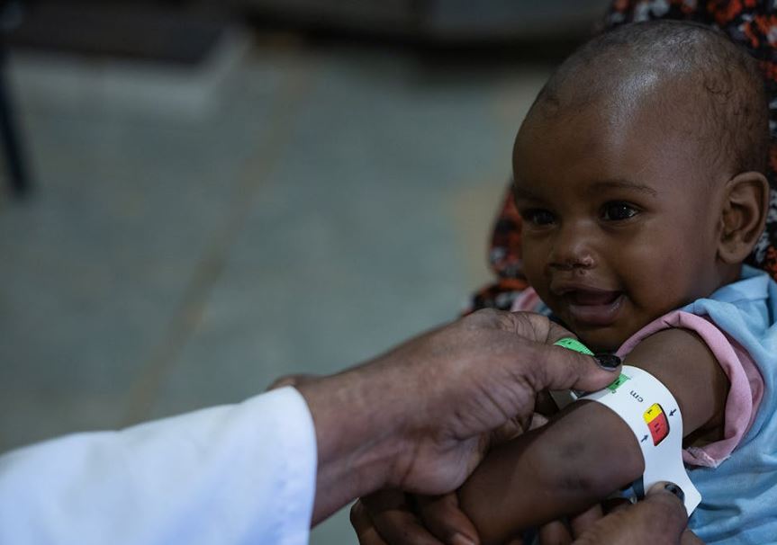 Sudan: 825.000 bambini a rischio di morte per grave malnutrizione, avvertono FAO, WFP e UNICEF