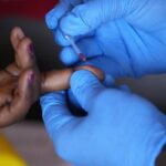 Gli Stati Uniti interrompono i finanziamenti per la lotta contro l'HIV in Sudafrica