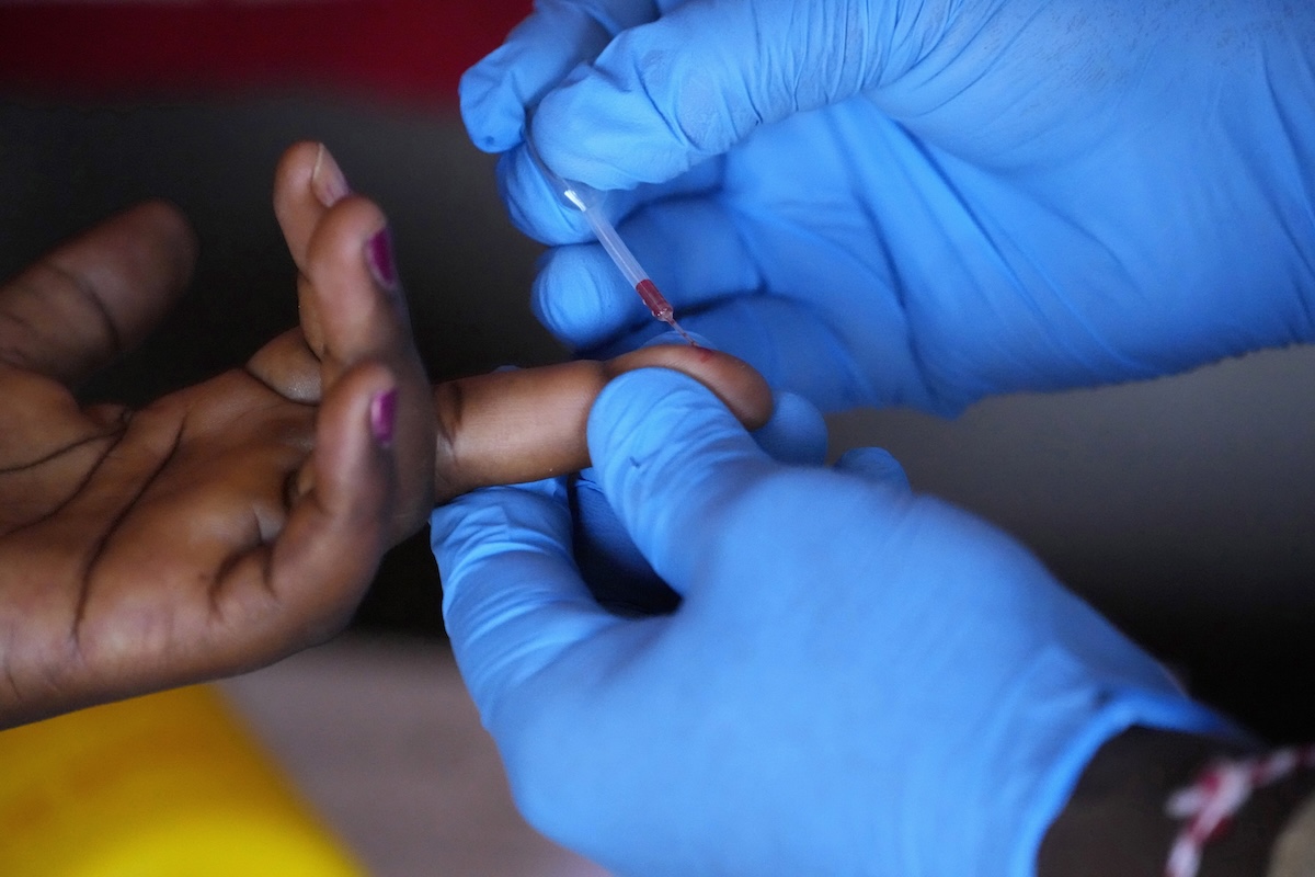 Gli Stati Uniti interrompono i finanziamenti per la lotta contro l'HIV in Sudafrica