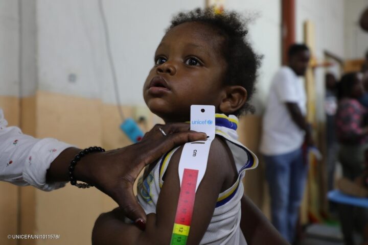 Emergenza nutrizionale ad Haiti: quasi un bambino su tredici sotto i 5 anni è affetto da malnutrizione acuta