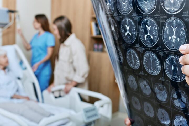 Parkinson: sintomi e diagnosi, Dario Franceschini rivela di convivere con la malattia