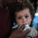 Unicef: tassi allarmanti di malnutrizione cronica tra bambini e madri a Gaza