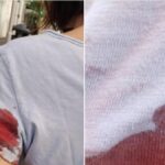 Arrestato il presunto cecchino nel quartiere Prati di Roma dopo il ferimento di una scrittrice