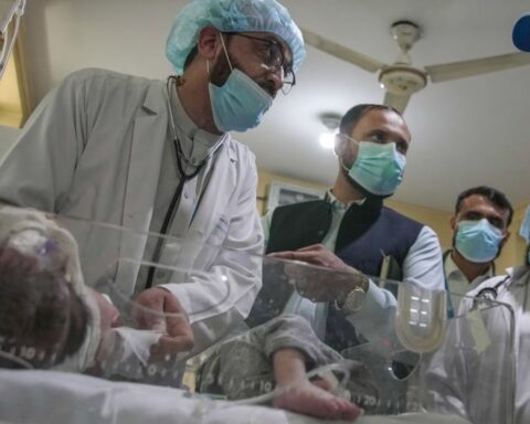 Aumento drammatico della malnutrizione infantile in Afghanistan, avverte l'UNICEF